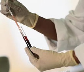 test delle immunoglobuline danno epatico